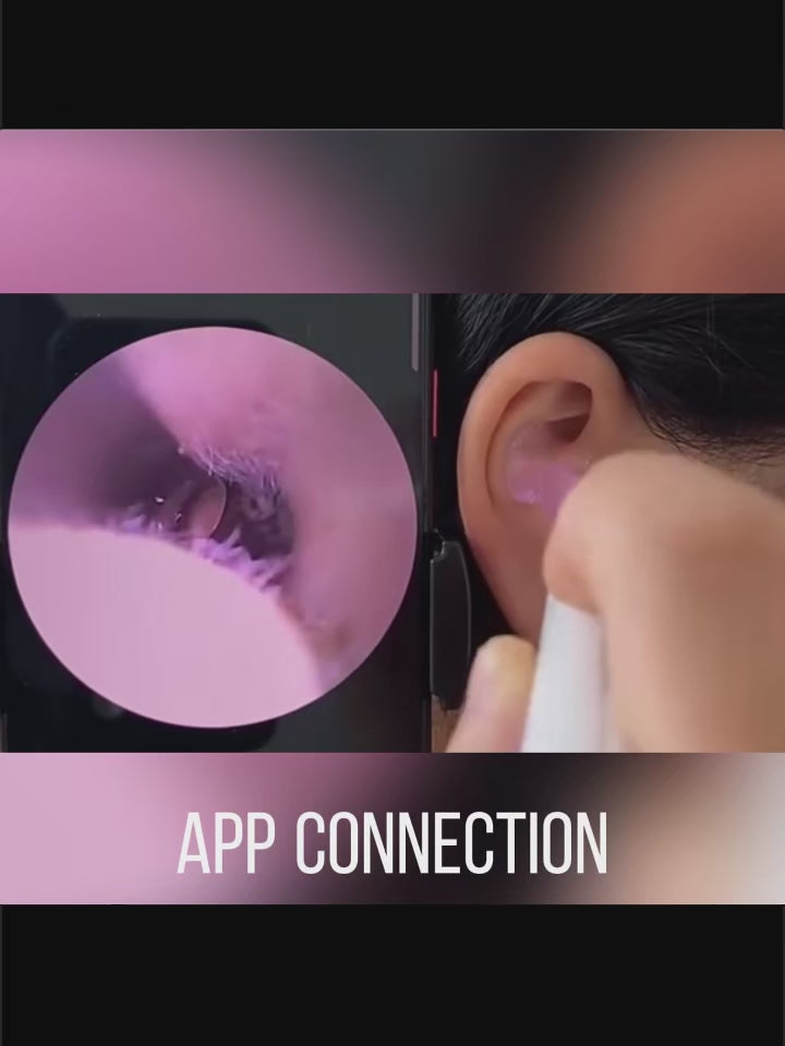 Earwax Removal Kit